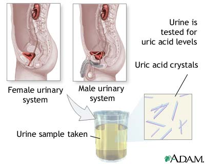 Uric acid test Uric acid test