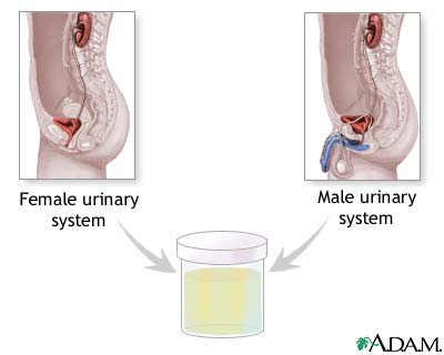 Urine test Urine test