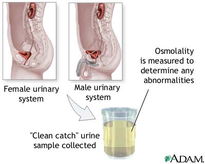 Osmolality test Osmolality test