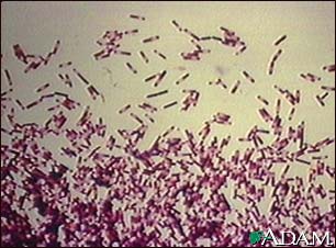 Clostridium difficile organism Clostridium difficile organism