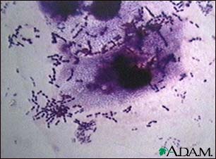 Pneumococci organism