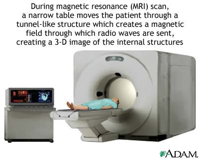 MRI scans MRI scans