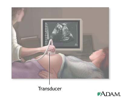 Ultrasound in pregnancy