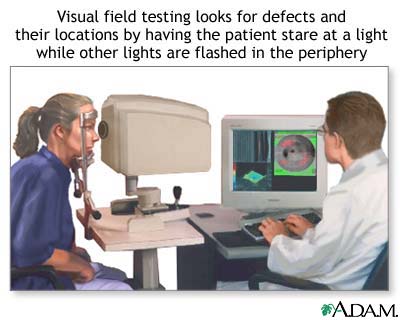 Visual field test