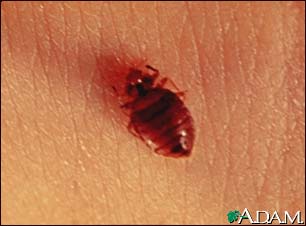 Bedbug - close-up