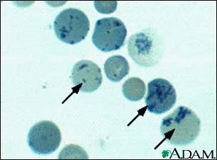 Reticulocytes