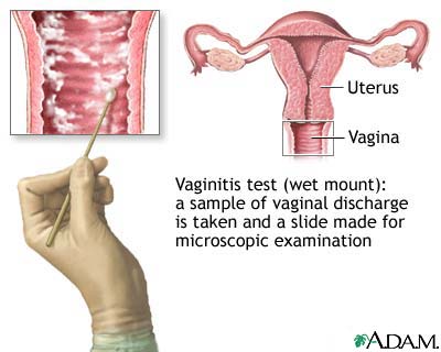 The wet mount vaginitis test