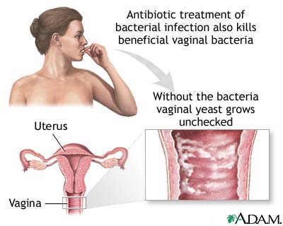 Secondary infection