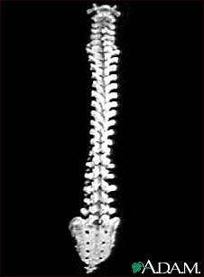 Vertebral column