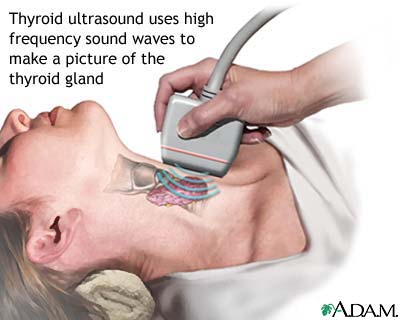 Thyroid ultrasound Thyroid ultrasound