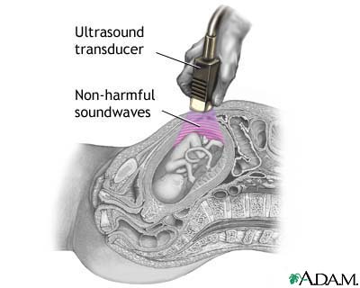 Ultrasound Ultrasound