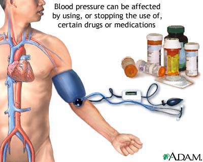 Drug induced hypertension Drug induced hypertension