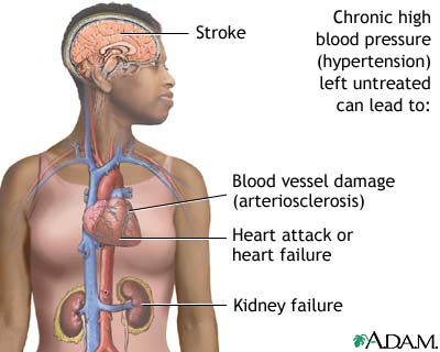 Untreated hypertension