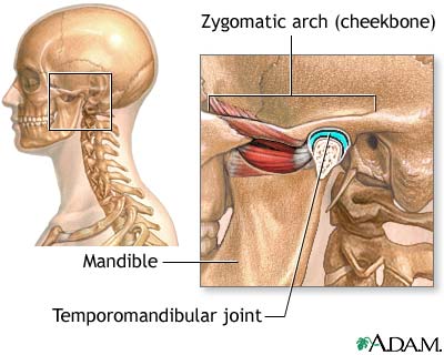 Causes of secondary headache Causes of secondary headache