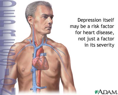 Depression and heart disease Depression and heart disease
