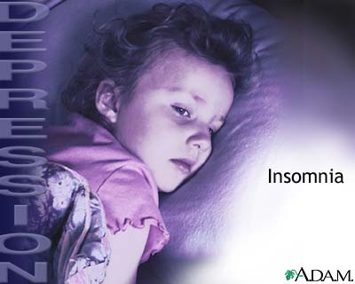 Depression and insomnia Depression and insomnia
