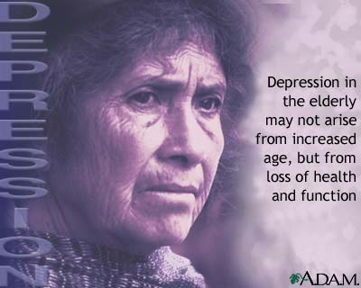 Depression among the elderly Depression among the elderly