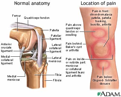 Knee pain