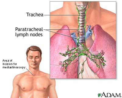 Mediastinum