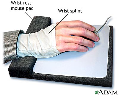 Wrist splint