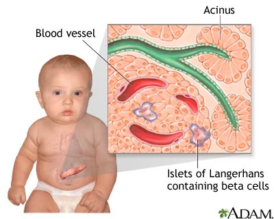 Hyperglycemia Hyperglycemia