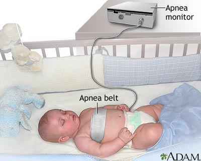 Apnea monitor Apnea monitor